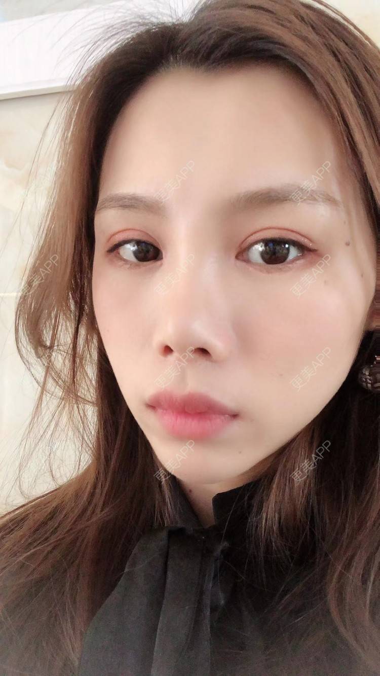 眼不见为净心不烦的眼综合日记