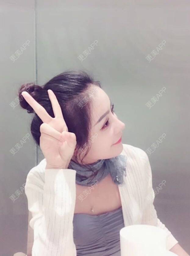 更美 - 怀拥你的鼻部多项经验 | 鼻部多项 | 南京