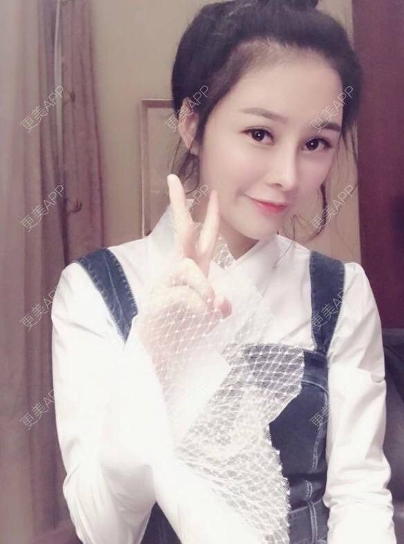 更美 - 怀拥你的鼻部多项经验 | 鼻部多项 | 南京