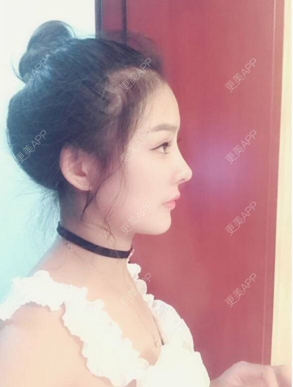 更美 - 怀拥你的鼻部多项经验 | 鼻部多项 | 南京