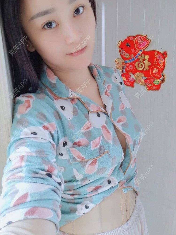 更美 - 仙剑奇侠传灵儿的自体脂肪隆胸日记 | 自体脂肪隆胸 | 美胸