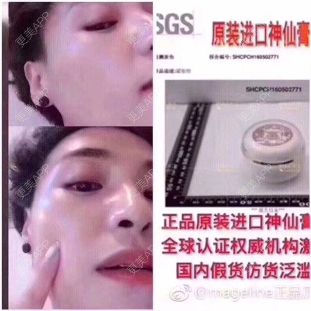 更美 - 卫星co66878的黑脸娃娃经验 | PRP自体血清美肤 | 黑脸娃娃 | 注射美白 | 深圳