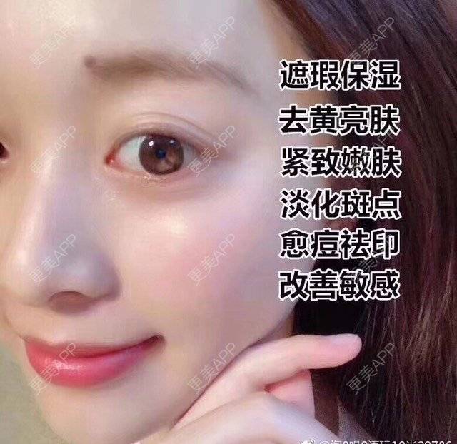 更美 - 卫星co66878的黑脸娃娃经验 | PRP自体血清美肤 | 黑脸娃娃 | 注射美白 | 深圳