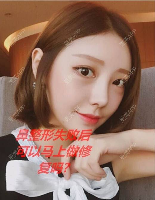 更美 - 康华清医疗美容门诊部的鼻部膨体假体取出经验 | 鼻部膨体假体取出 | 鼻形态修复 | 鼻部硅胶假体取出