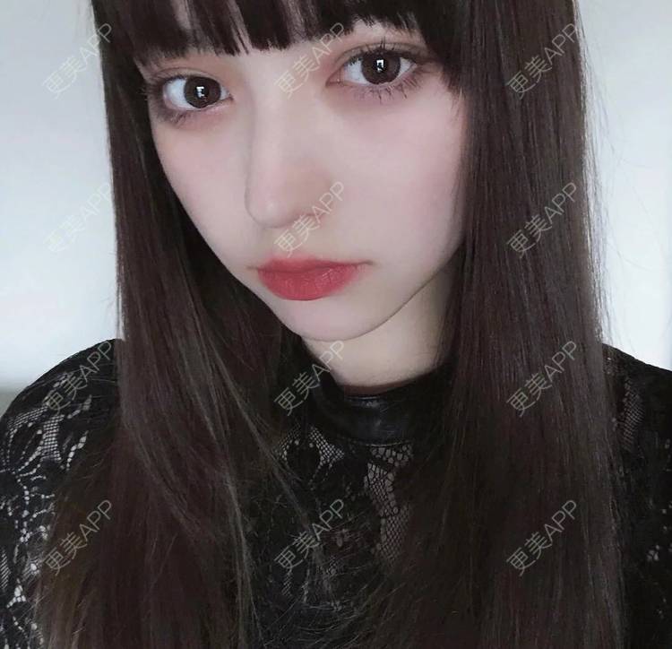 更美 - 陌离子子的鼻部综合经验 | 重庆 | 鼻翼缩小 | 鼻部综合