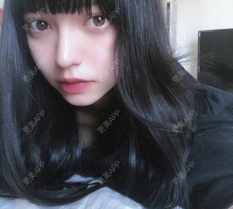 更美 - 陌离子子的鼻部综合经验 | 重庆 | 鼻翼缩小 | 鼻部综合