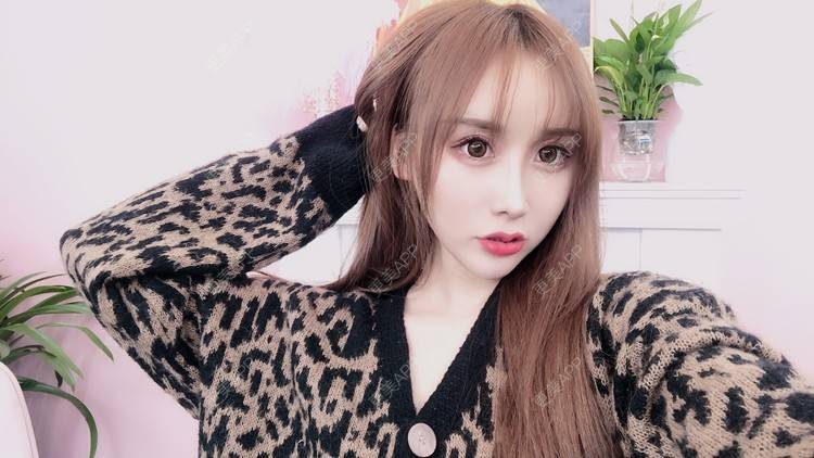 更美 - MeYou00的自体脂肪丰苹果肌经验 | 自体脂肪丰苹果肌 | 自体脂肪全面部填充 | 自体脂肪丰面颊 | 自体脂肪丰太阳穴 | 杭州 | 自体脂肪丰额头 | 视频日记