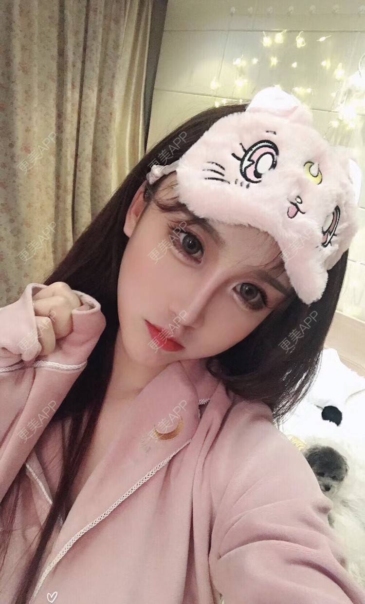 更美 - MeYou00的自体脂肪丰苹果肌经验 | 自体脂肪丰苹果肌 | 自体脂肪全面部填充 | 自体脂肪丰面颊 | 自体脂肪丰太阳穴 | 杭州 | 自体脂肪丰额头 | 视频日记