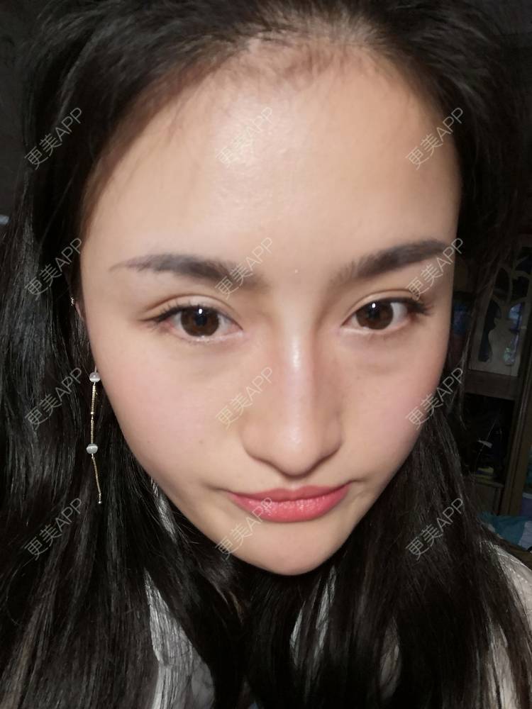 更美 - 淑芳宅_斋的除皱瘦脸经验 | 除皱瘦脸 | 长沙