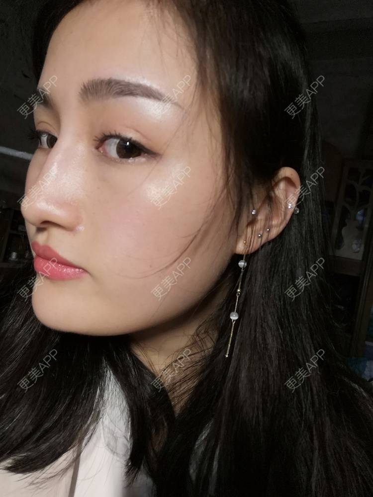 更美 - 淑芳宅_斋的除皱瘦脸经验 | 除皱瘦脸 | 长沙