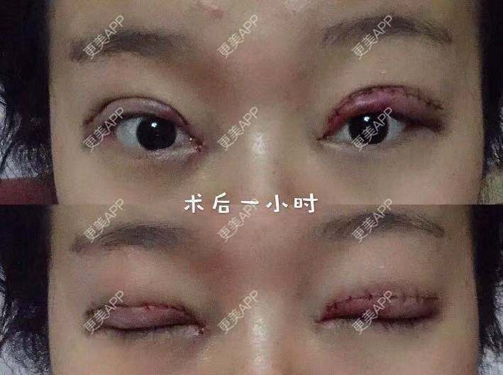 更美 - 刘艳 医生的眼部多项经验 | 眼部多项