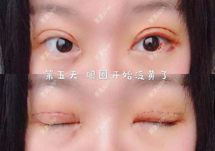 更美 - 刘艳 医生的眼部多项经验 | 眼部多项