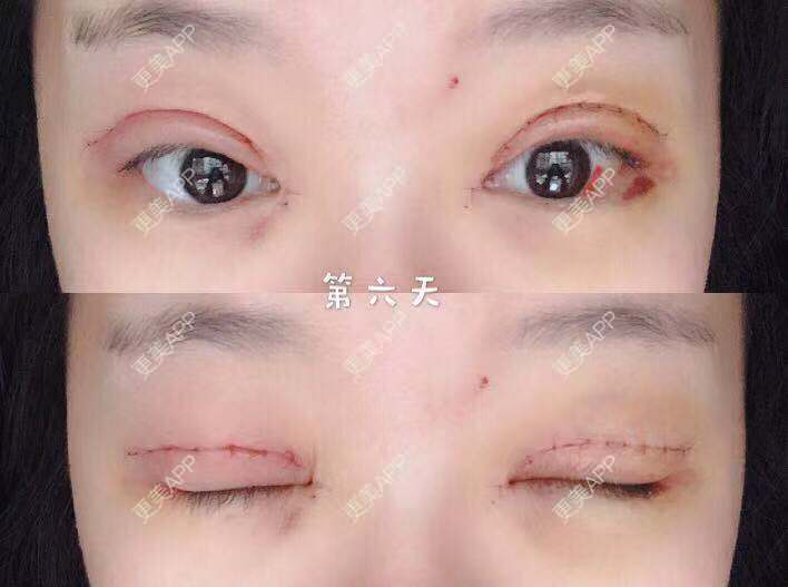 更美 - 刘艳 医生的眼部多项经验 | 眼部多项