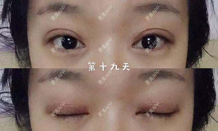 更美 - 刘艳 医生的眼部多项经验 | 眼部多项