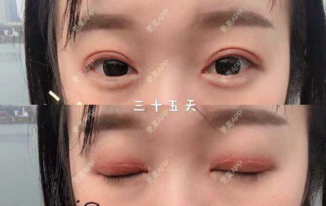 更美 - 刘艳 医生的眼部多项经验 | 眼部多项