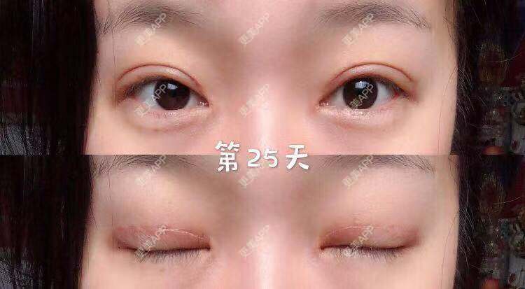 更美 - 刘艳 医生的眼部多项经验 | 眼部多项