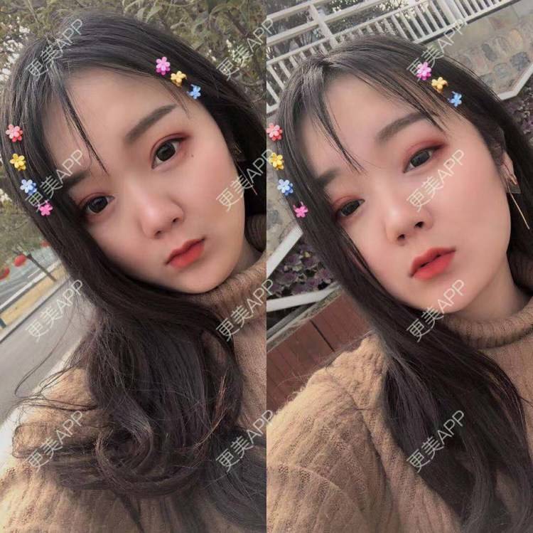 更美 - 刘艳 医生的眼部多项经验 | 眼部多项