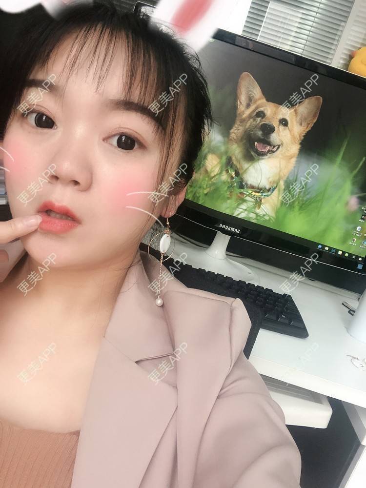 更美 - 刘艳 医生的眼部多项经验 | 眼部多项