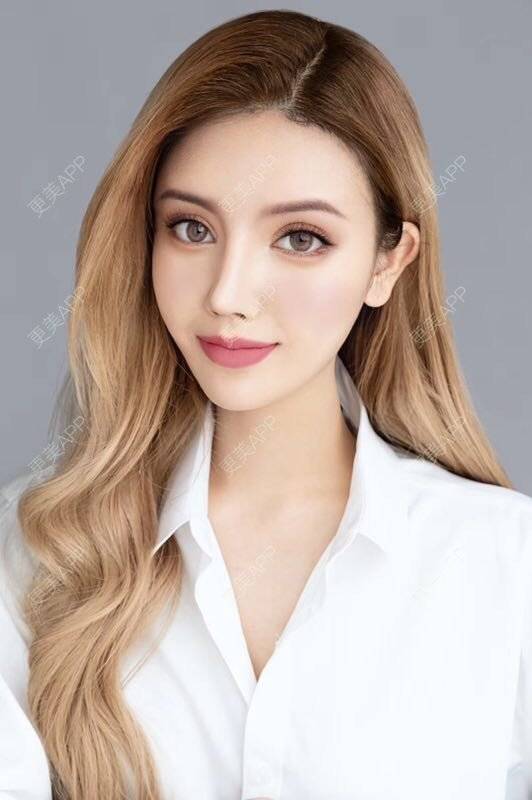 更美 - 小宋宋宋的唇腭裂修复经验 | 胶原蛋白丰唇 | 自体脂肪丰唇 | 玻尿酸唇部 | 酒窝成形 | 唇腭裂修复 | 厚唇改薄 | 成都 | M唇成形 | 微笑唇手术 | 唇综合