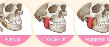 李志海 医生