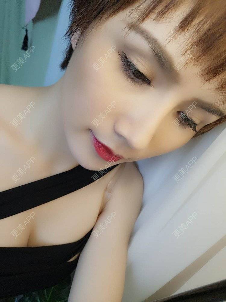 更美 - 一捧保鲜花的唇腭裂修复经验 | 唇综合 | 厚唇改薄 | 胶原蛋白丰唇 | 玻尿酸唇部 | 唇腭裂修复 | 成都 | M唇成形 | 微笑唇手术