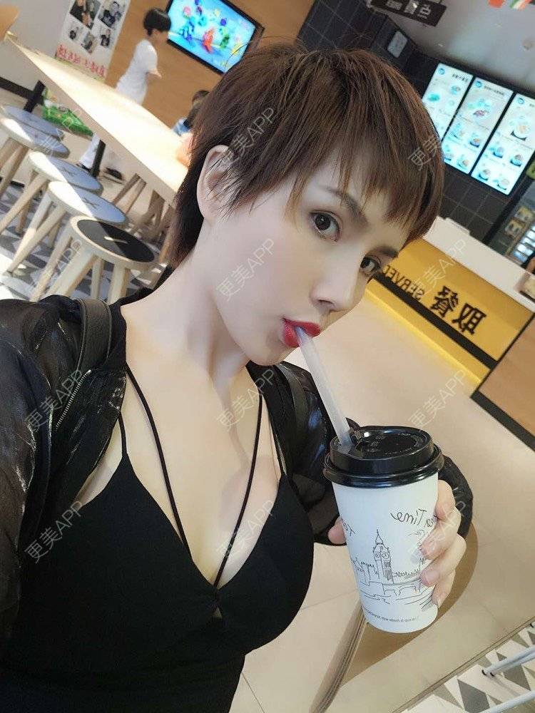 更美 - 一捧保鲜花的唇腭裂修复经验 | 唇综合 | 厚唇改薄 | 胶原蛋白丰唇 | 玻尿酸唇部 | 唇腭裂修复 | 成都 | M唇成形 | 微笑唇手术