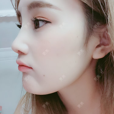 爱人不过是碍人
