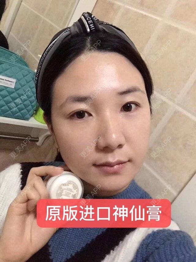 更美 - 卫星co66878的点阵激光经验 | 视频日记 | 化学剥脱淡斑 | 点阵激光 | 注射美白 | 深圳