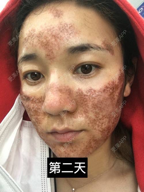 更美用户7isr1u6acf的点阵激光日记