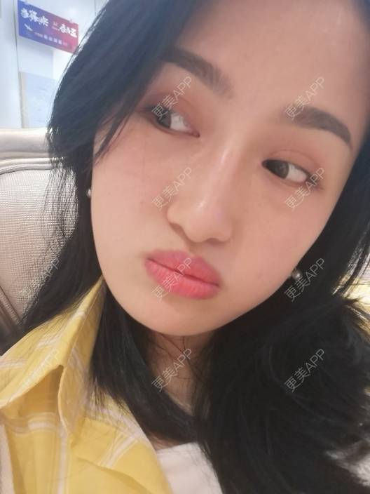 更美 - 淑芳宅_斋的除皱瘦脸经验 | 除皱瘦脸 | 长沙