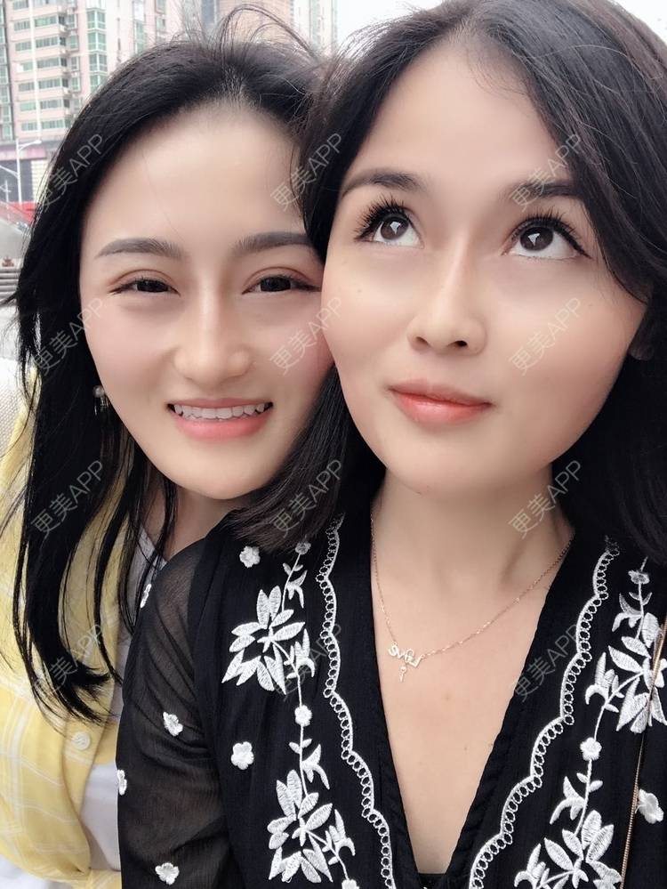 更美 - 淑芳宅_斋的除皱瘦脸经验 | 除皱瘦脸 | 长沙