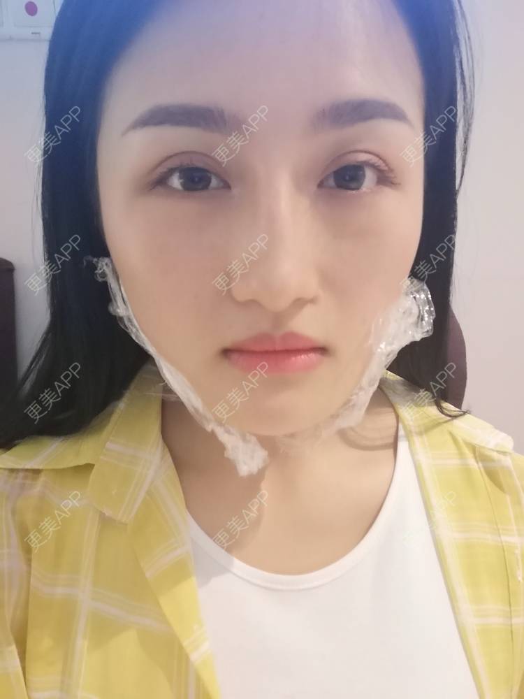 更美 - 淑芳宅_斋的除皱瘦脸经验 | 除皱瘦脸 | 长沙