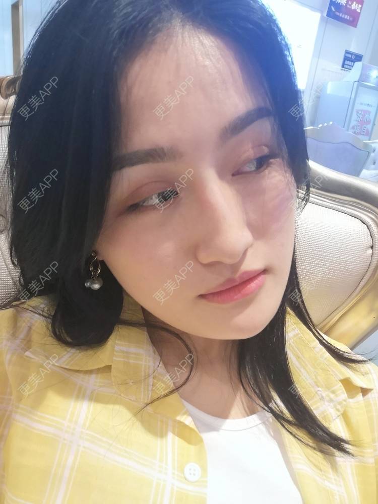 更美 - 淑芳宅_斋的除皱瘦脸经验 | 除皱瘦脸 | 长沙