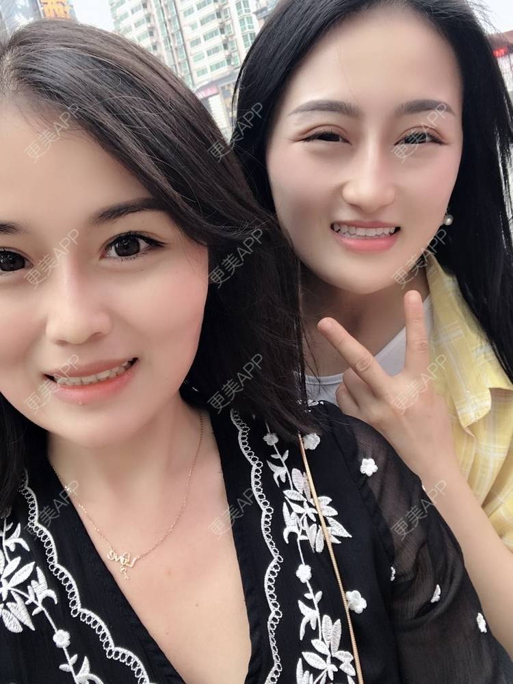 更美 - 淑芳宅_斋的除皱瘦脸经验 | 除皱瘦脸 | 长沙