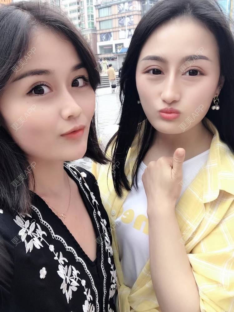 更美 - 淑芳宅_斋的除皱瘦脸经验 | 除皱瘦脸 | 长沙