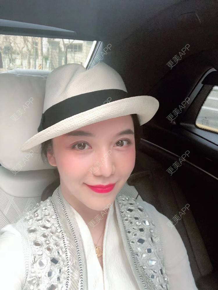 更美 - 悦怡姐姐的私处填充经验 | 私处填充 | 腰腹吸脂 | 吸脂瘦大腿 | 上海 | 自体脂肪全面部填充
