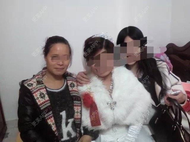 更美 - 卫星co66878的像素激光经验 | 像素激光 | 化学剥脱淡斑 | 注射美白 | 深圳