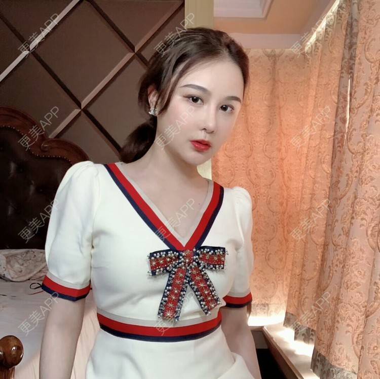 更美 - 李李李李子的隆鼻经验 | 隆鼻 | 硅胶隆鼻 | 耳软骨隆鼻 | 鼻翼缩小 | 鼻部多项 | 鼻翼 | 鼻部修复 | 温州 | 鼻形态修复 | 真皮隆鼻 | 鼻部综合