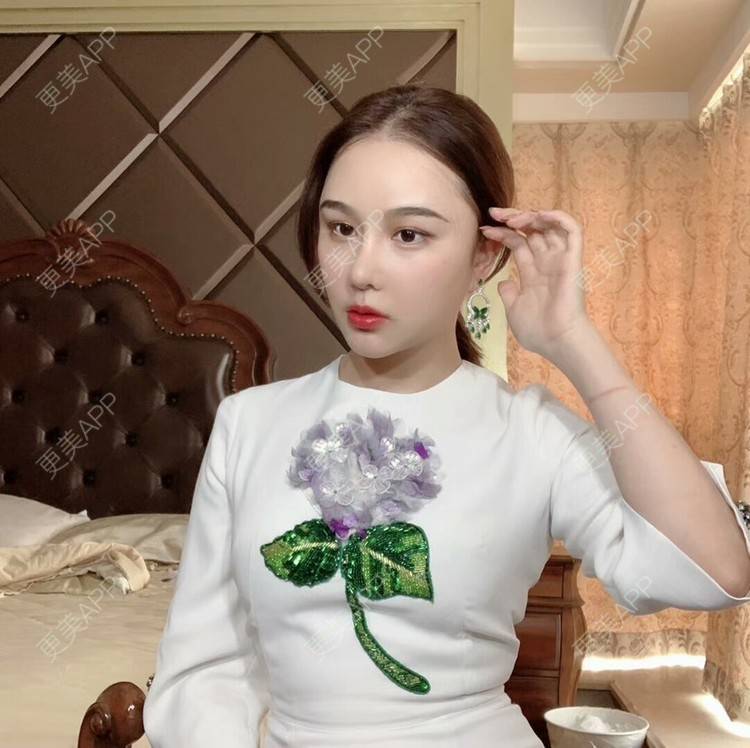 更美 - 李李李李子的隆鼻经验 | 隆鼻 | 硅胶隆鼻 | 耳软骨隆鼻 | 鼻翼缩小 | 鼻部多项 | 鼻翼 | 鼻部修复 | 温州 | 鼻形态修复 | 真皮隆鼻 | 鼻部综合