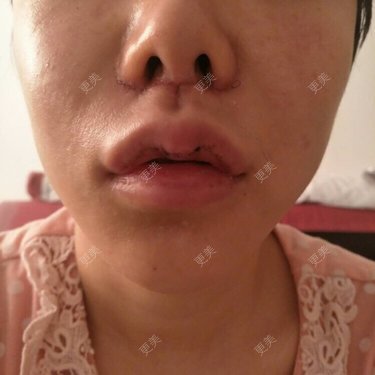 僵尸涵