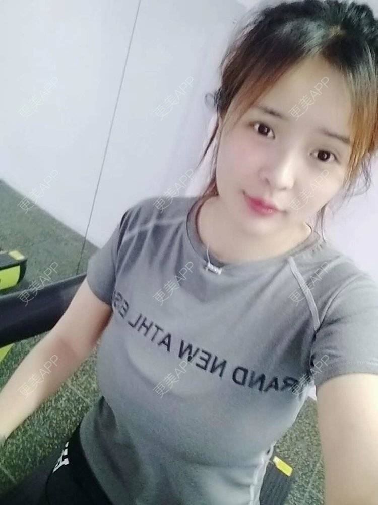 更美 - 更美用户XB4UPdP4Tq的玻尿酸黑眼圈经验 | 玻尿酸黑眼圈 | 广州
