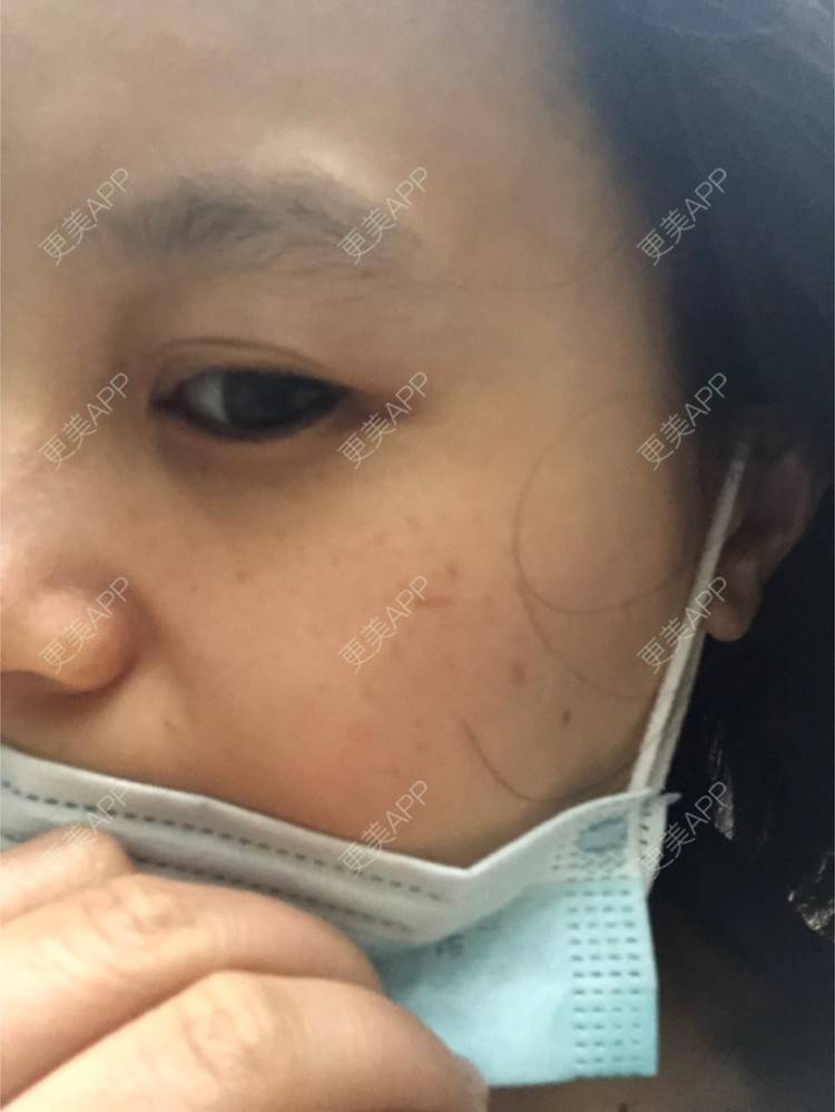 更美 - 一白遮三丑丑丑的舒敏之星经验 | 上海 | 舒敏之星