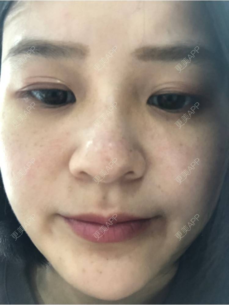 更美 - 一白遮三丑丑丑的舒敏之星经验 | 上海 | 舒敏之星