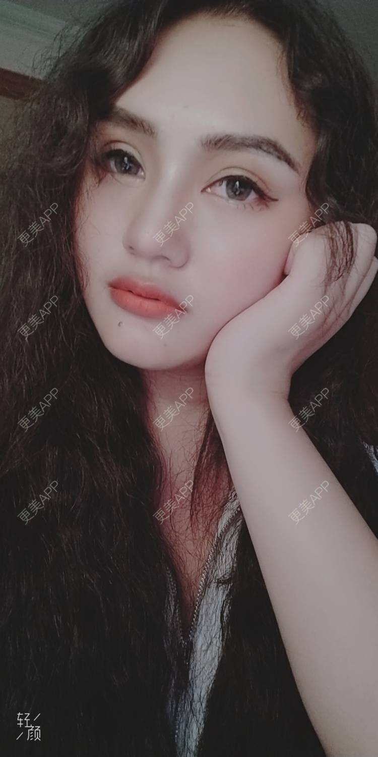 更美 - 红薯冰的硅胶垫眉弓经验 | 北京 | 硅胶垫眉弓