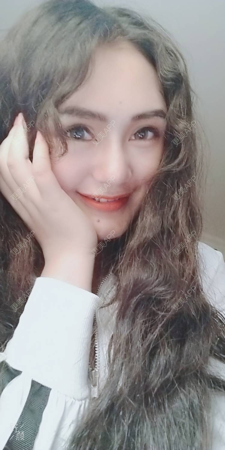 更美 - 红薯冰的硅胶垫眉弓经验 | 北京 | 硅胶垫眉弓