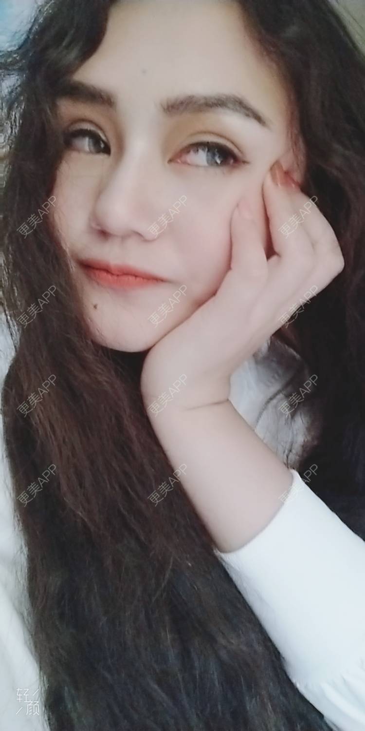 更美 - 红薯冰的硅胶垫眉弓经验 | 北京 | 硅胶垫眉弓