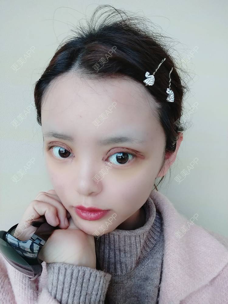 洋娃娃最可爱的眼综合日记