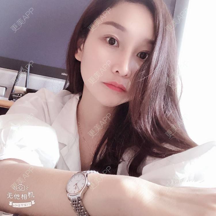 更美 - 蒙蒙噜噜噜的双眼皮修复经验 | 上海 | 双眼皮修复