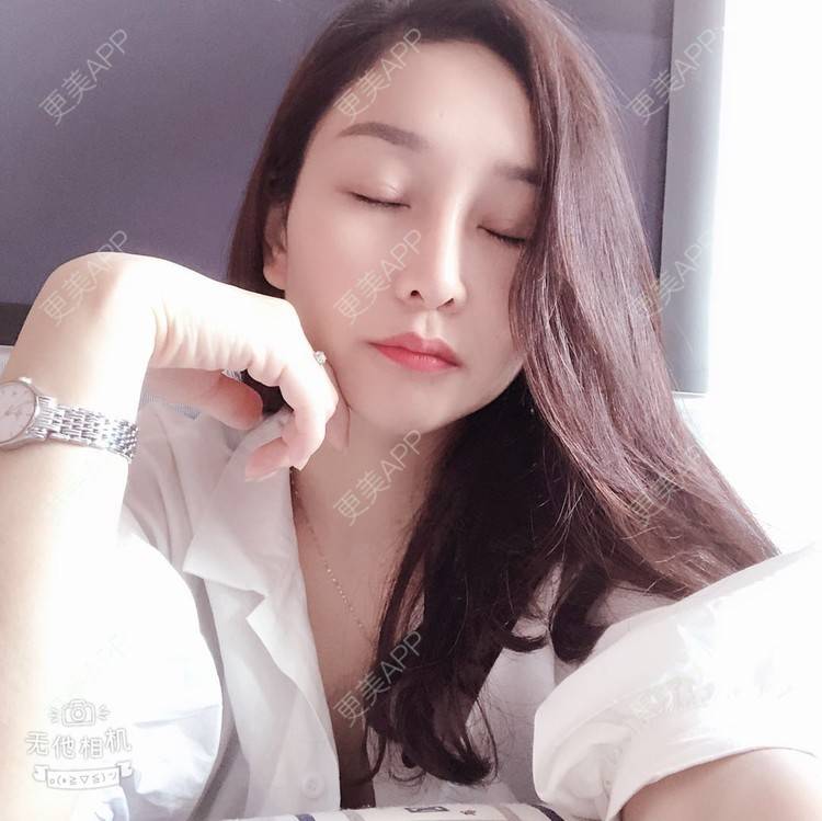 更美 - 蒙蒙噜噜噜的双眼皮修复经验 | 上海 | 双眼皮修复