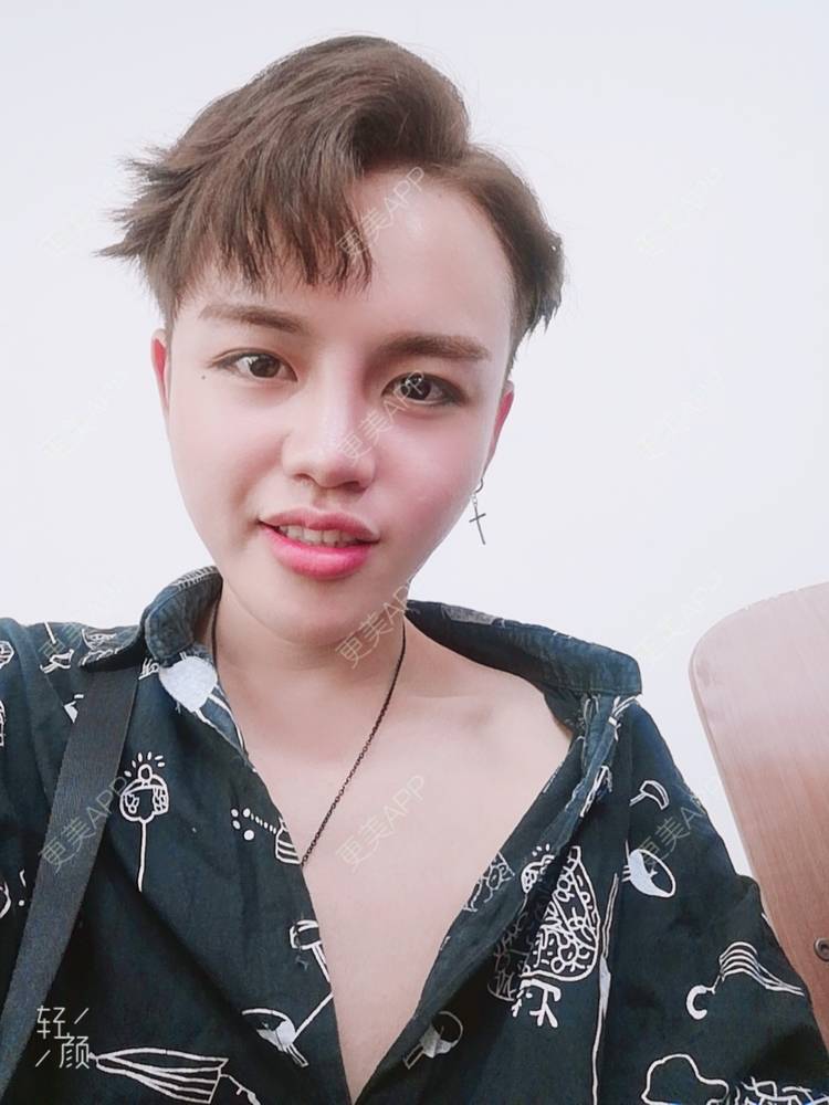 更美 - 更美用户吕祥的面部脱毛经验 | 面部脱毛 | 武汉